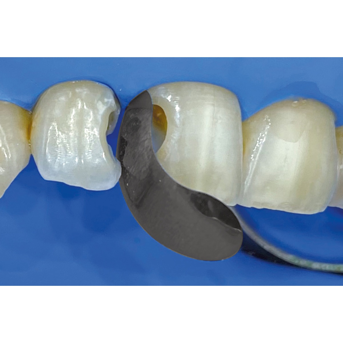 Polydentia QuickmatFLEX Sectional Matrices