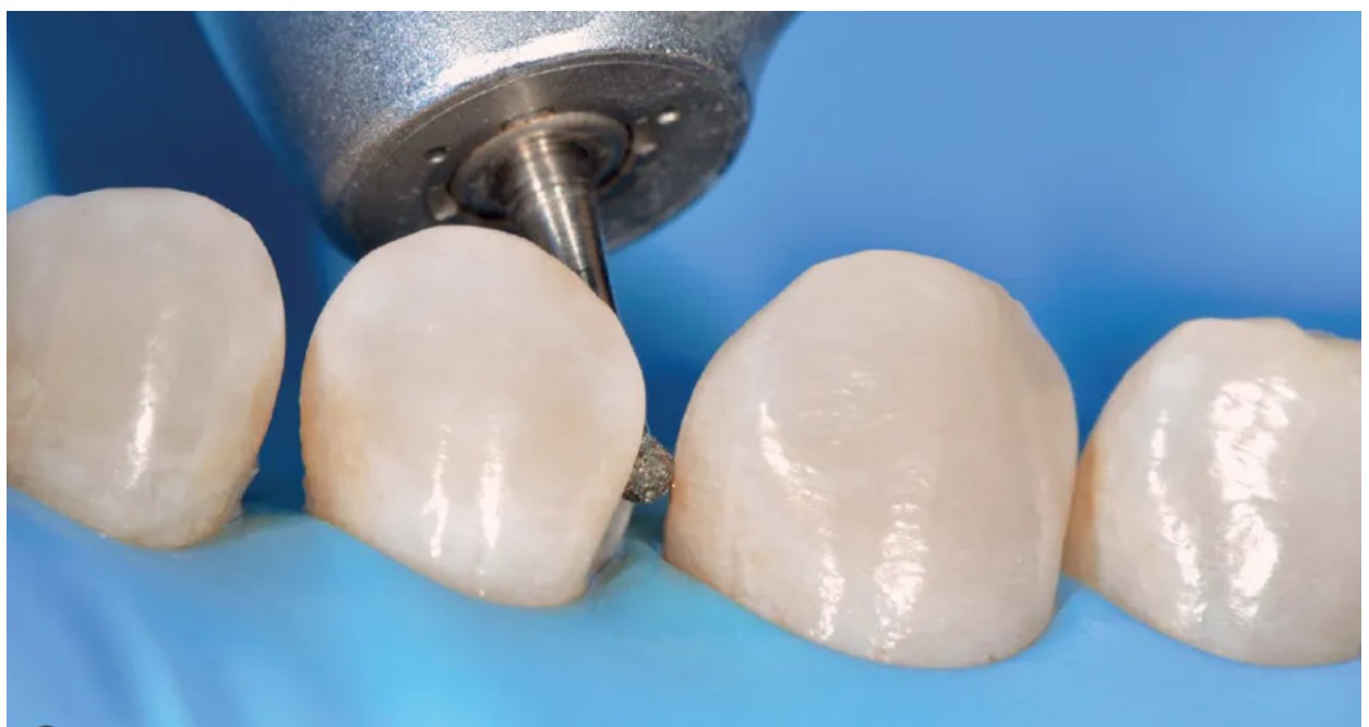 NSK Contrangle Handpiece FX 22