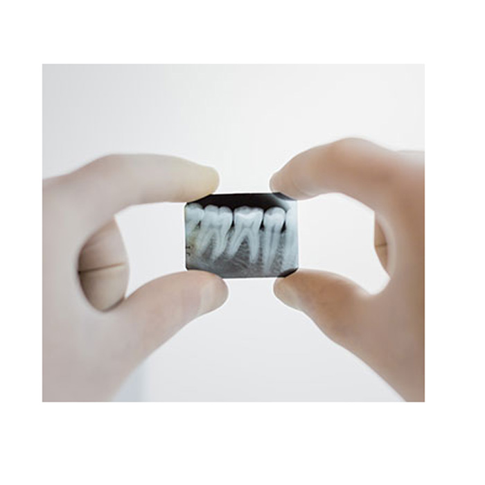 Waldent Dental X-Ray Film E-Speed (Pack Of 100)