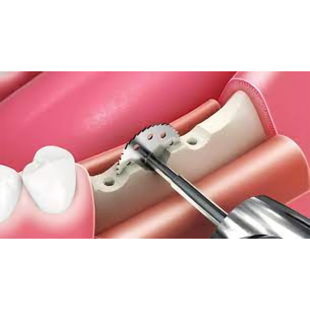 MCTBIO Split Master 2 Disk Saw