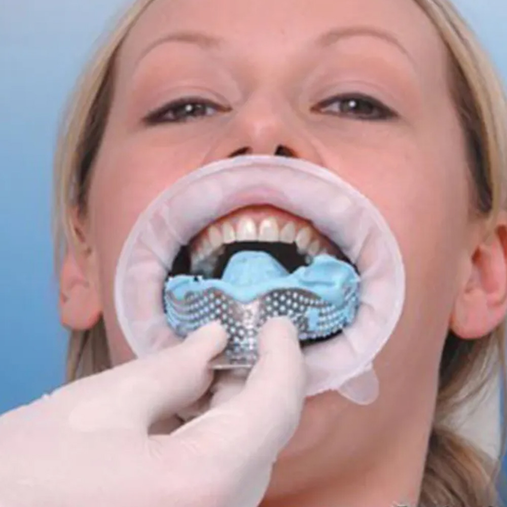 Oracraft Impression Tray Dentulous Perforated Kit Set of 8 - ITRLDPP8