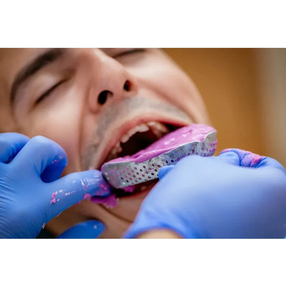 Oracraft Impression Tray Dentulous Perforated Kit Set of 8 - ITRLDPP8