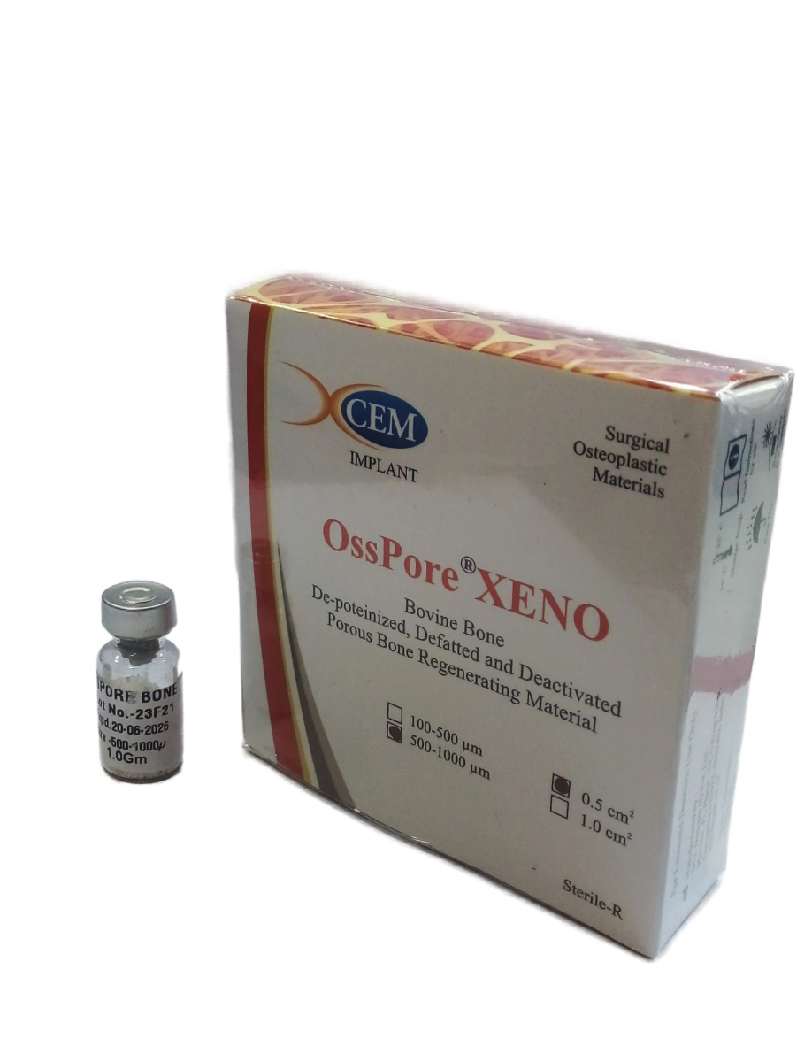 Xcem Osspore Bovine Bone Graft 0.5cc - XTB101