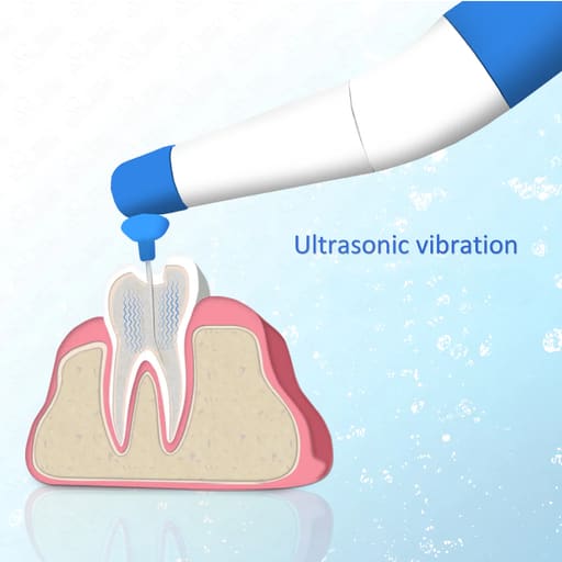 Dontics Endo Sonic Activator