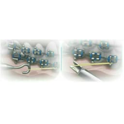 Waldent Dontrix Gauge - 2816 (10/136)       - 3
