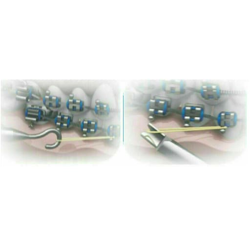 Waldent Dontrix Gauge - 2816 (10/136)