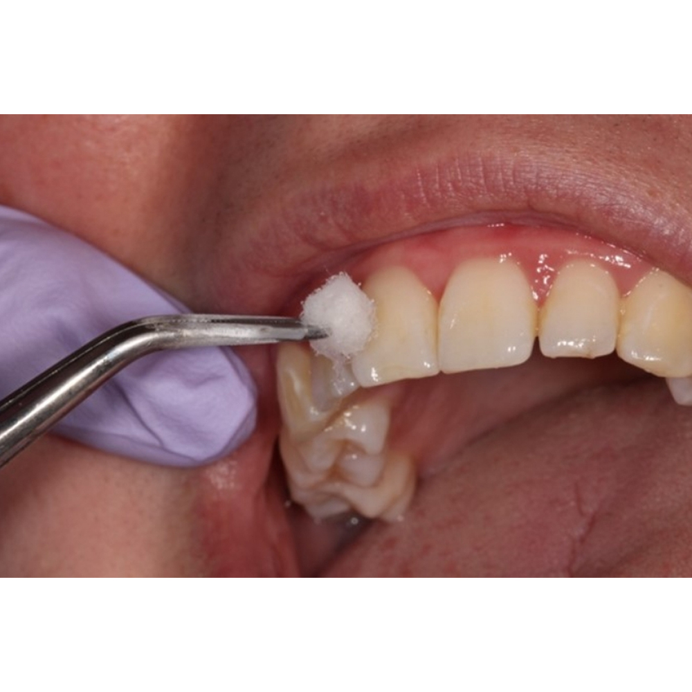 GDC Mariam Tweezer - Premium (Dp3)