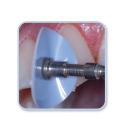 ET Dental Polishing Discs With Rivets Kit  - 4