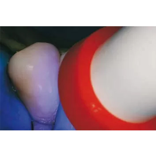 FGM Ambar Universal APS Bonding Agent 5ml