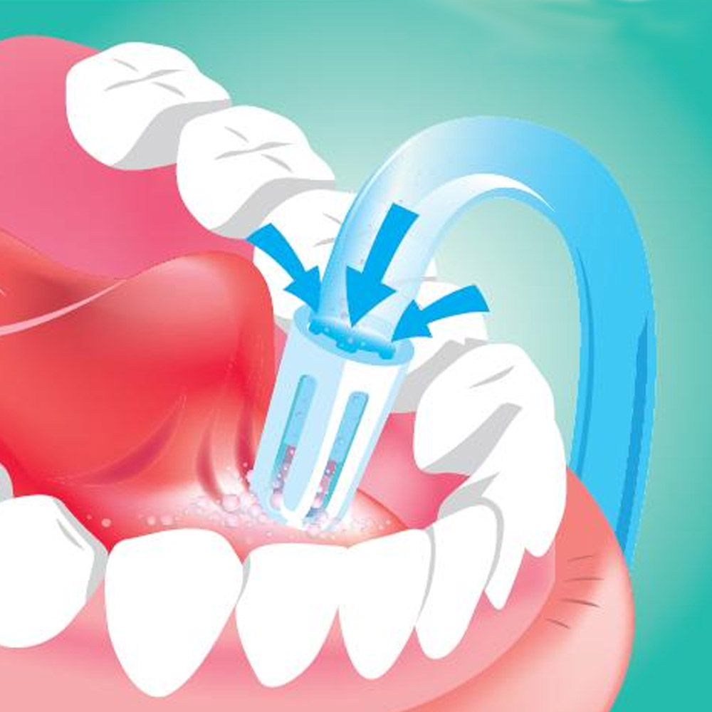 ET Dental Saliva Ejector