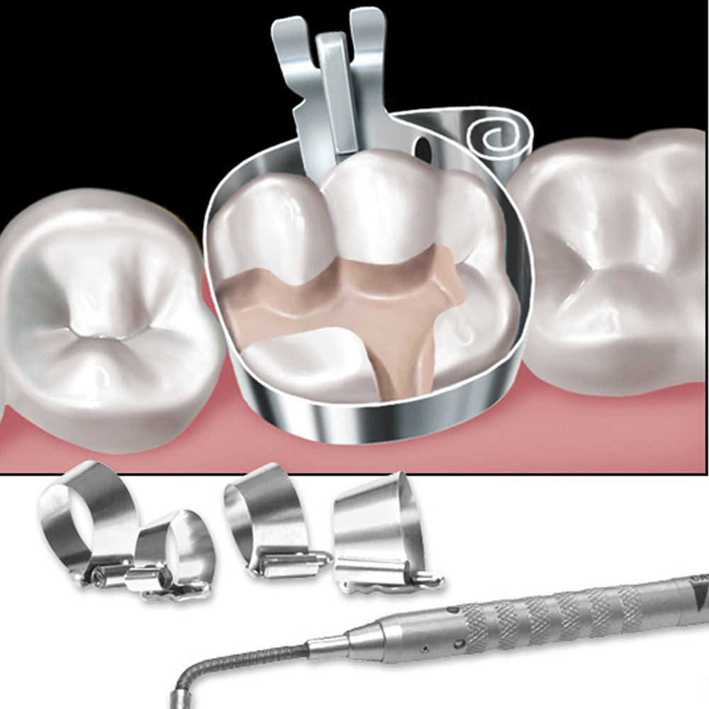 Dentsply AutoMatrix Refills
