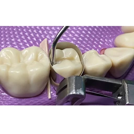 GDC Plastic Filling Instrument - 3 (PF2)
