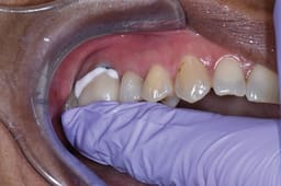 Prevest Oratemp Ne Manual-Mix - 9