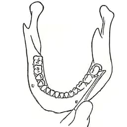 GDC Root Elevators Cryer - Left Premium (E31p) - 3