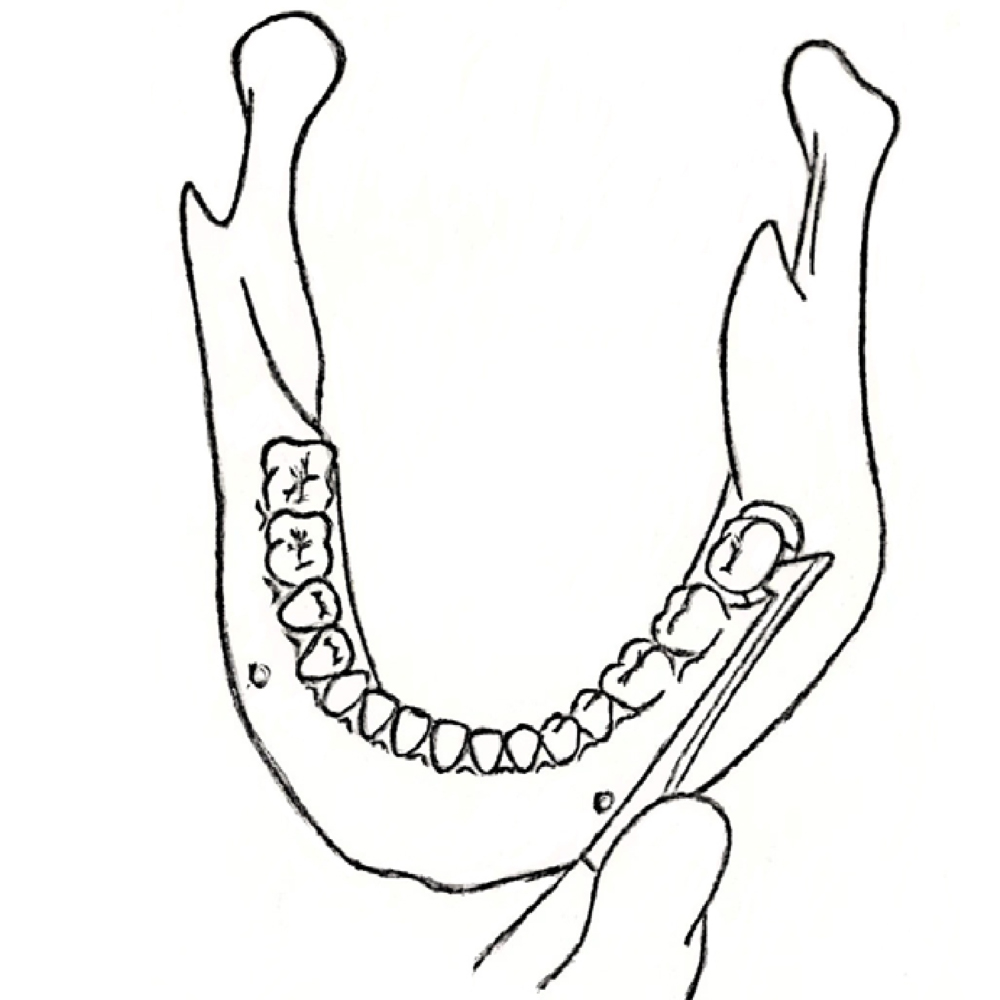 GDC Root Elevators Cryer - Left Standard (Ea30)