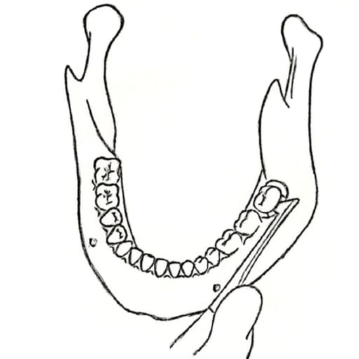 GDC Root Elevators Cryer - Left Standard (Ea30)