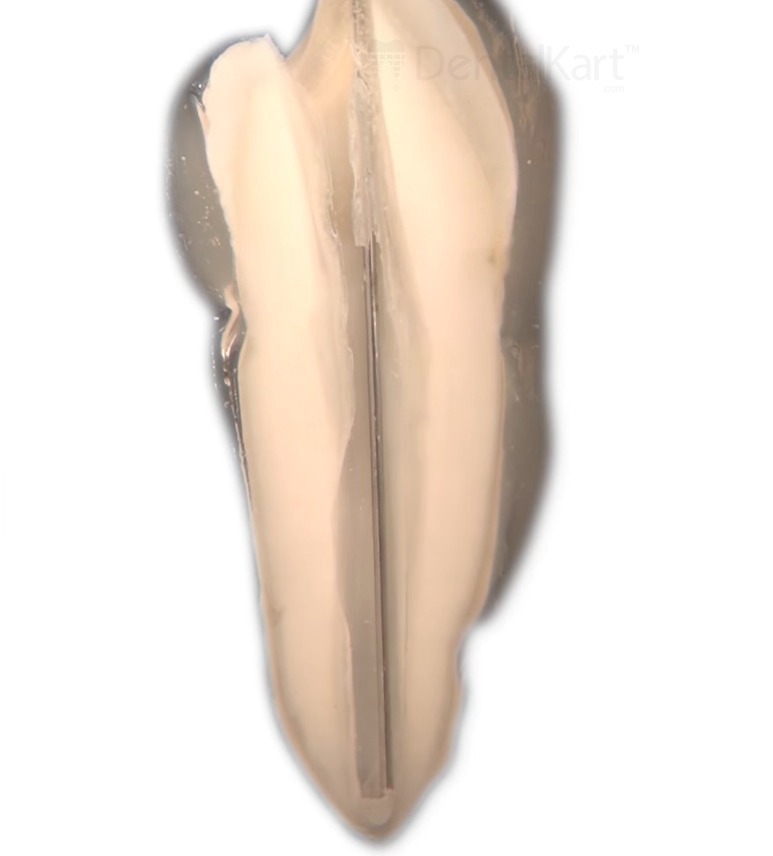 Waldent MTA Carrier 13cm