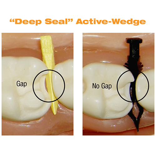 DualForce Active-Wedges