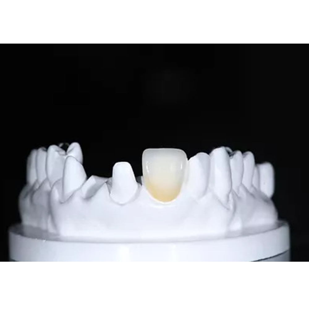 Aidite Cameo Glass Ceramic Blocks