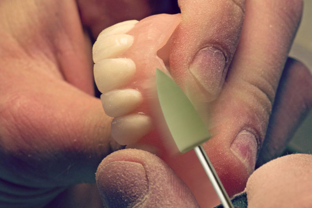 ET Dental Acrylic Polishers Points Slim (Pack of 1)