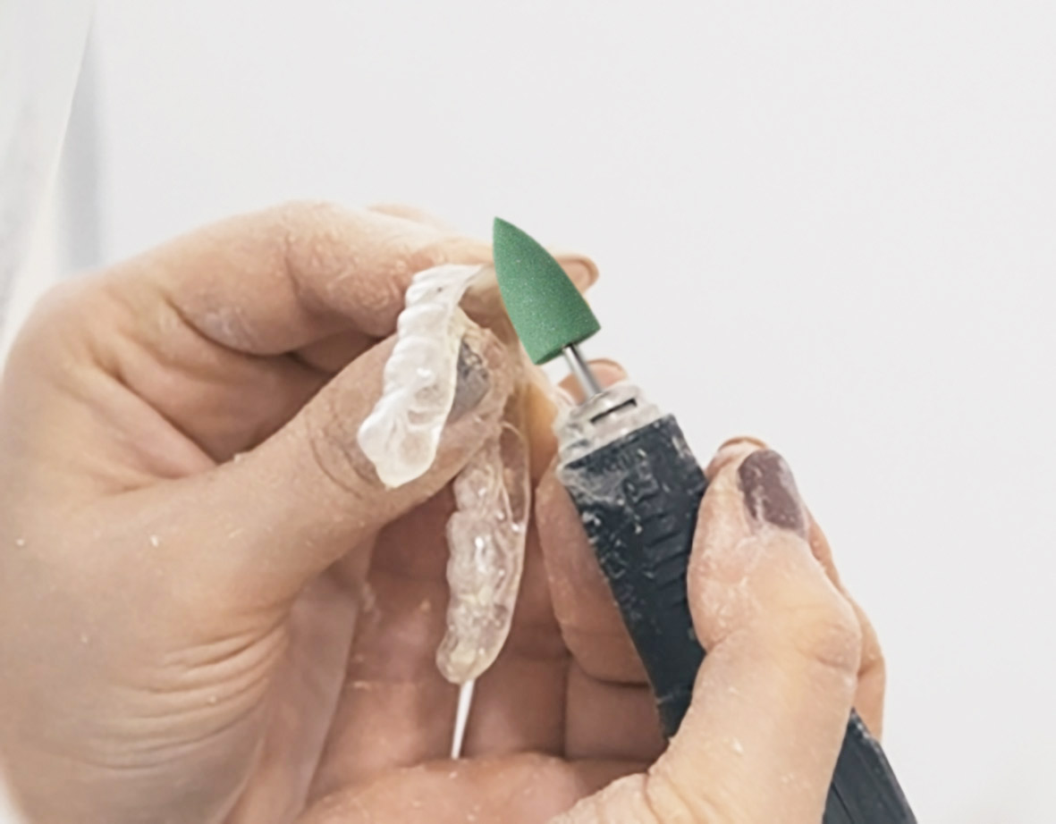 ET Dental Acrylic Polishers Points Big (Pack of 1)