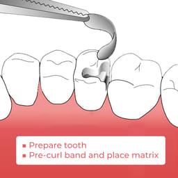 ET Dental Sectional Contoured Matrices Kit  - 13