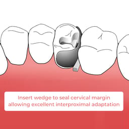 ET Dental Sectional Contoured Matrices Kit  - 10