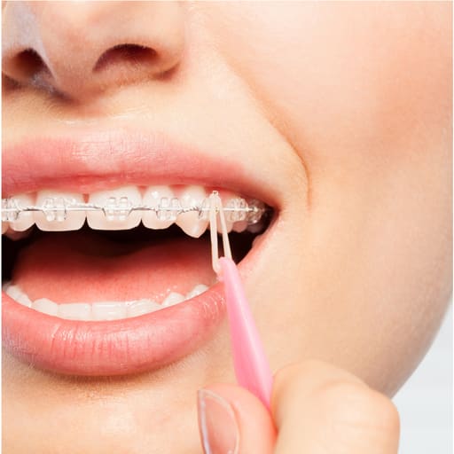 Penta Ortho Elastic Placer