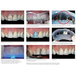 Zhermack Elite Glass (C401610) - 5