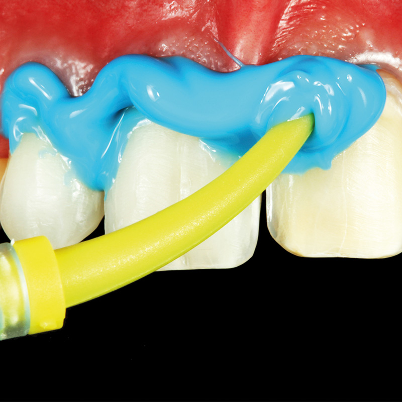 Zhermack Elite Hd+ Light Body Normal Set (Cartridge) (C203030)