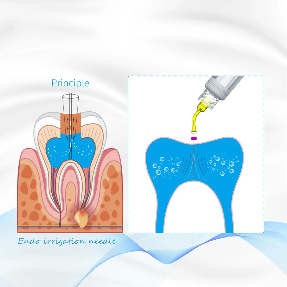 HN Dental Youni Endo 360