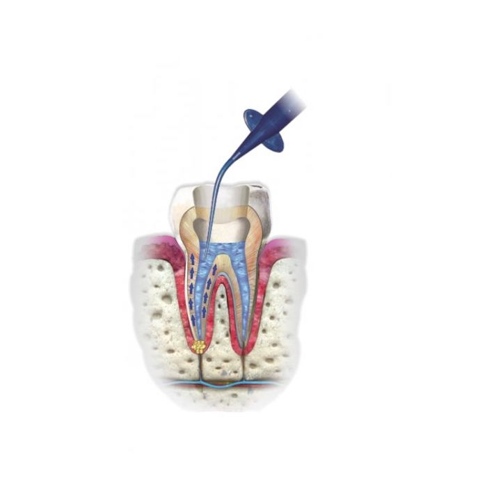 Cerkamed Endo Aspirator