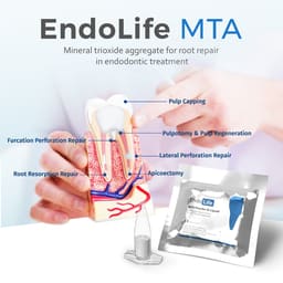 Waldent Endolife MTA (One Treatment Kit) - 8