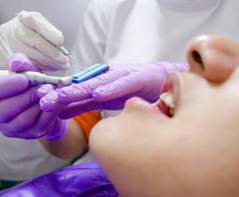 Waldent EndoPro Cordless Endomotor