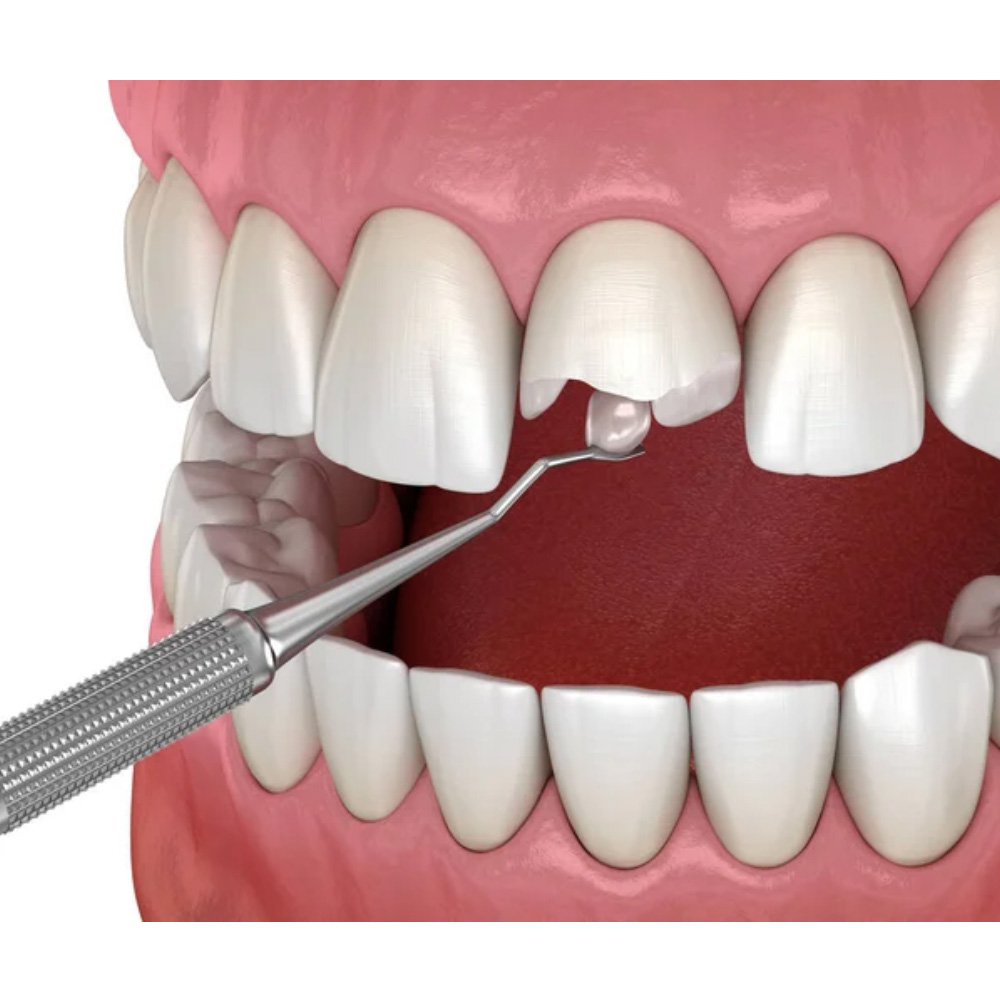 Septodont Endure Nano Hybrid Composite Kit