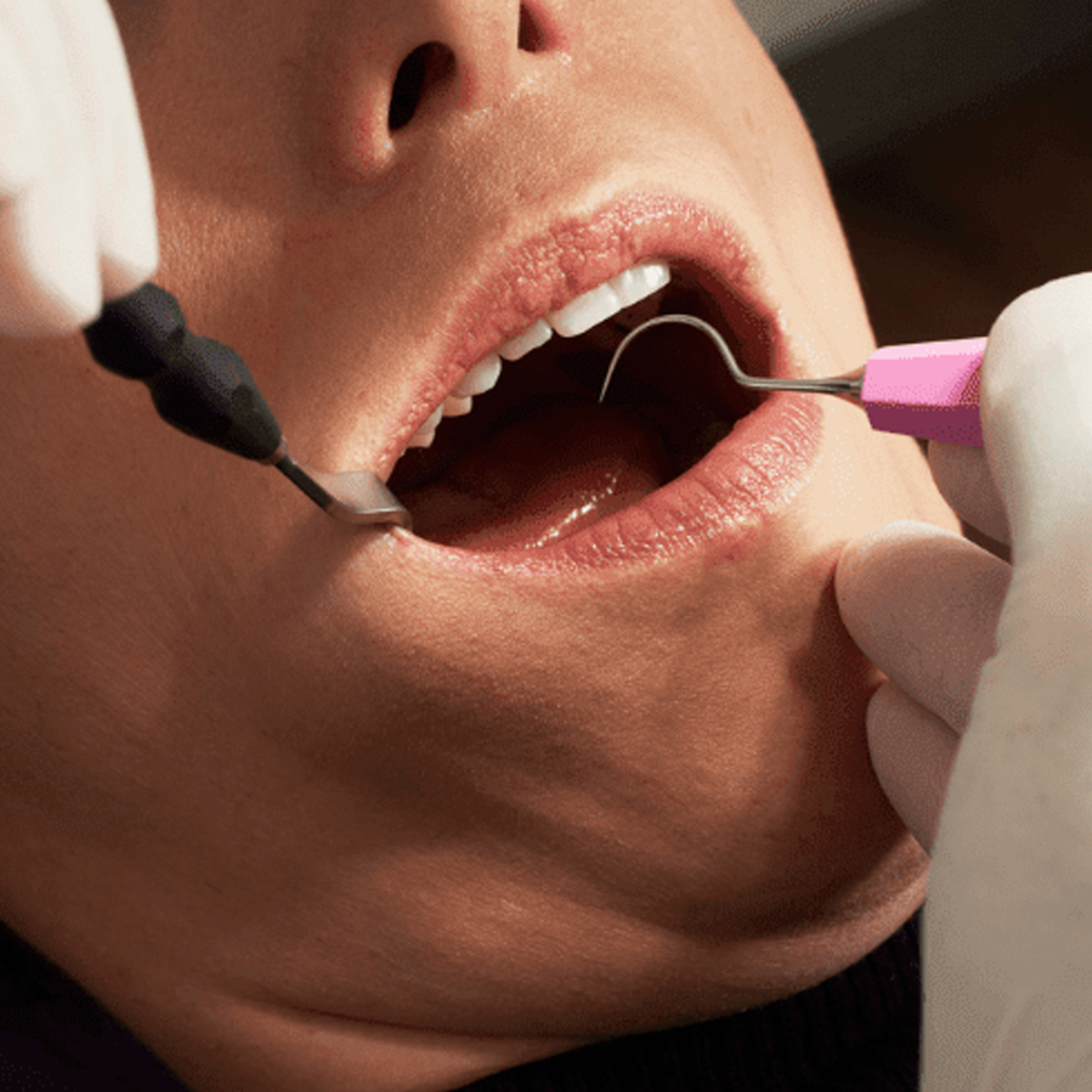 Hahnenkratt ERGOform Explorers