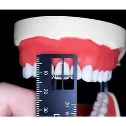 ET Dental Precision Measuring Ruler - 8