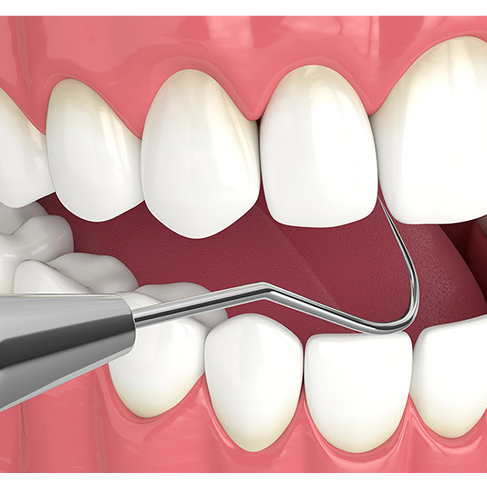 GDC Explorer With William Probe # 6 (EXP23/QW6)