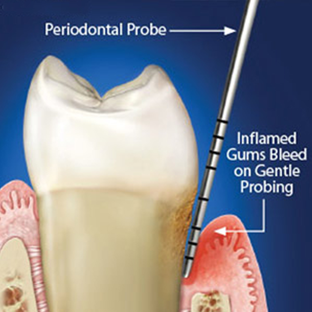 GDC Explorer With William Probe # 6 (EXP23/QW6)