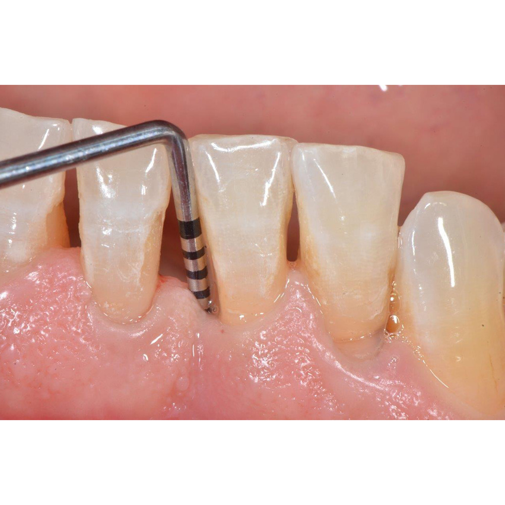 GDC Explorer With PCPUNC15 # 6 (EXP23/UNC15)