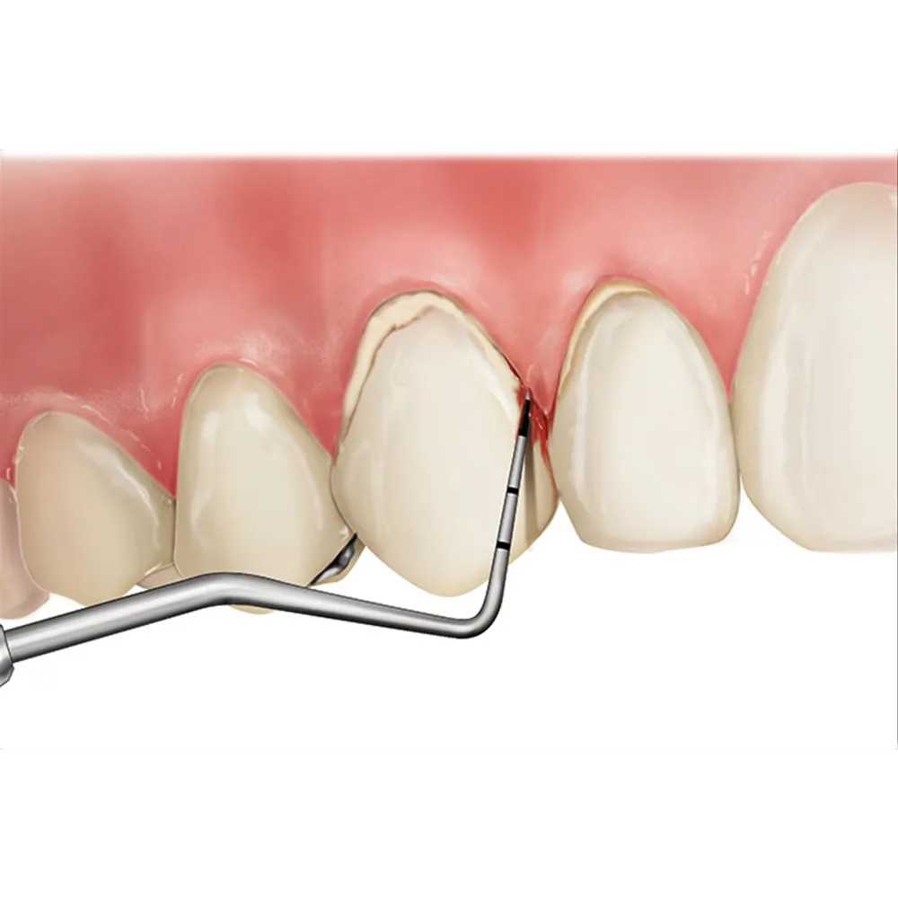 GDC Explorer With PCP11.5B #6 (EXP23/11.5B)