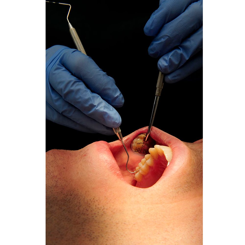 GDC Explorer With PCP11.5B #6 (EXP23/11.5B)