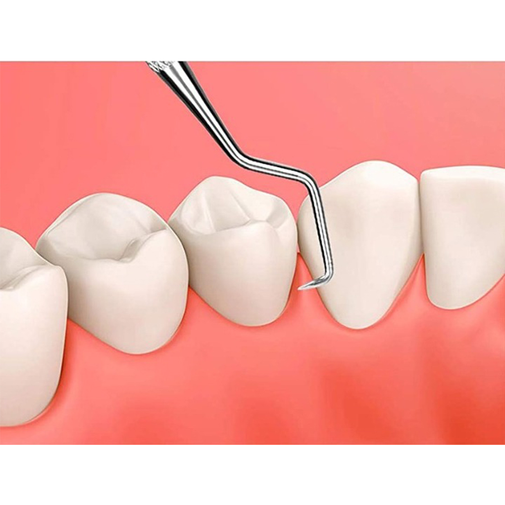 GDC Probe Explorer - Double Ended -4 (Exd5)