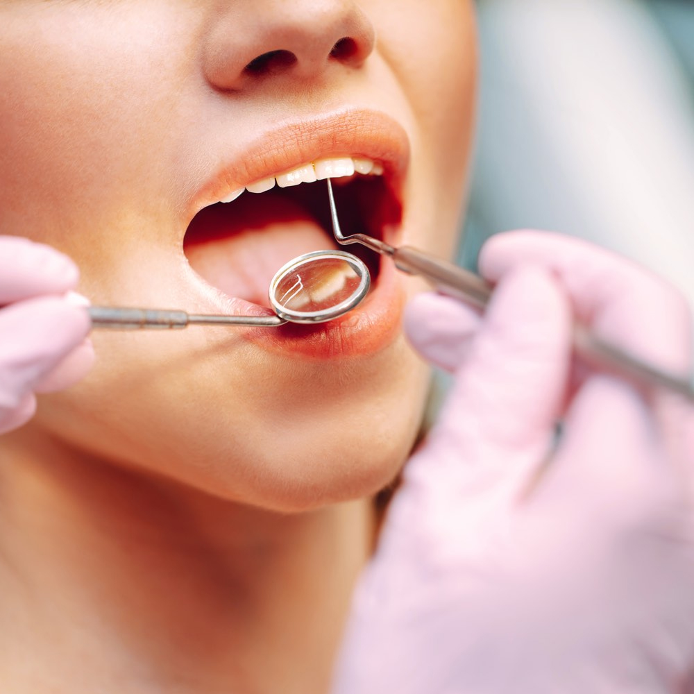 GDC Single End Probe #3 (EXS55)