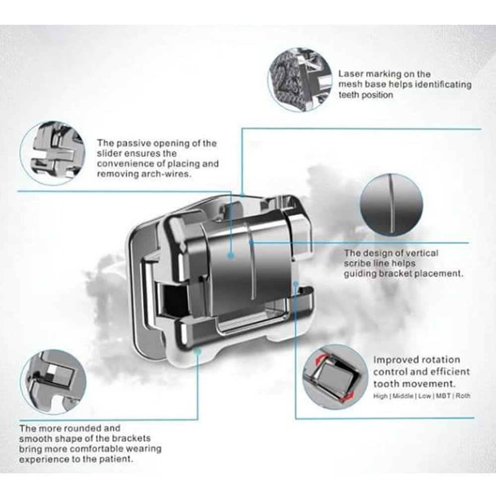 Koden EZ Lock MBT Metal Self Ligating Bracket Kits With 3 Sets of Cu NiTi Archwires