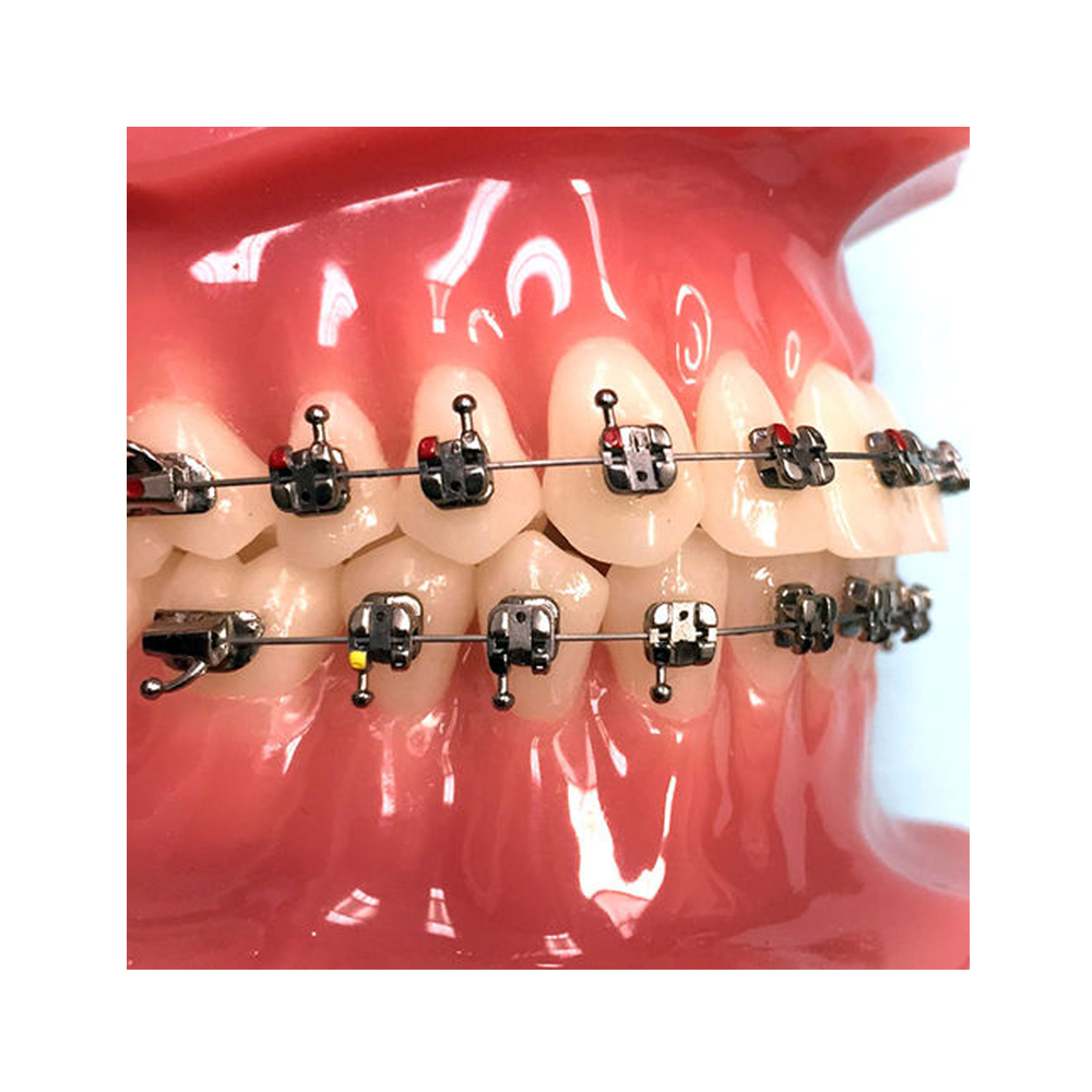 Koden EZ Lock MBT Metal Self Ligating Bracket Kits With 3 Sets of Cu NiTi Archwires