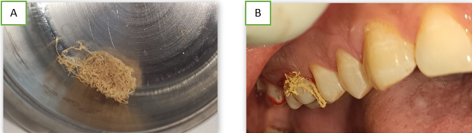 Advanced Biotech Periodontal Plus Ab