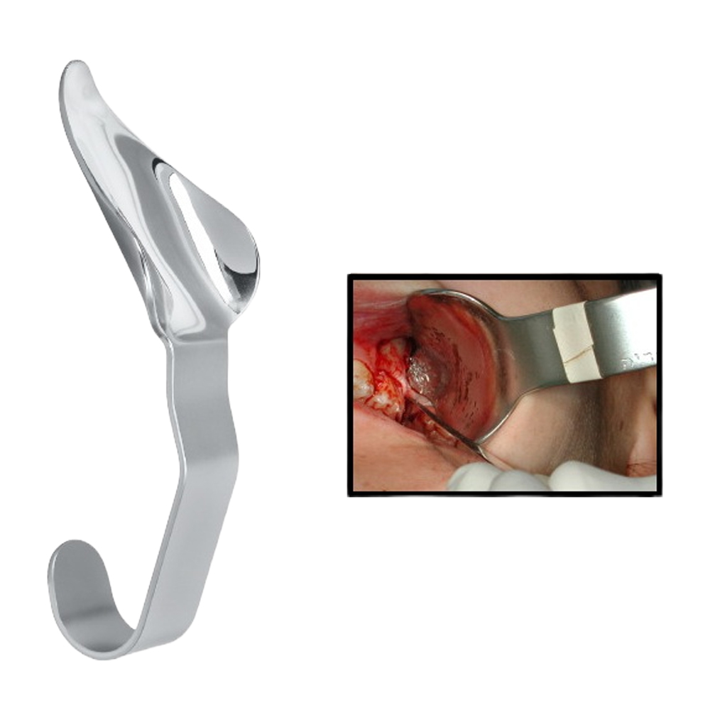 Julldent Laster 3rd Molar Retractor