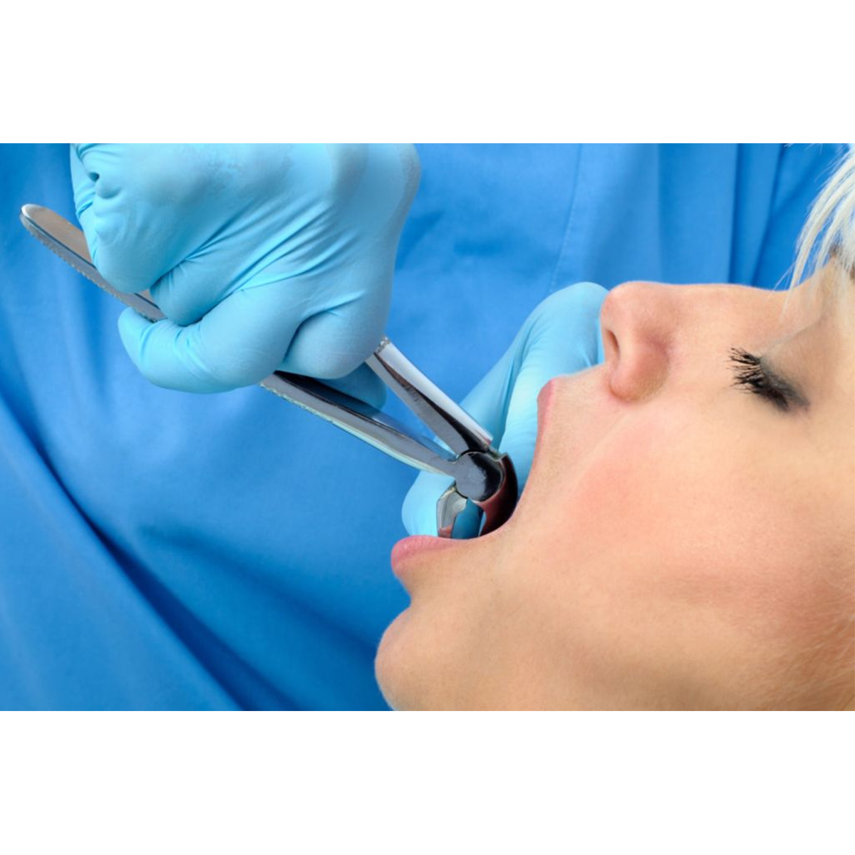 Waldent Tooth Extraction Forceps Lower Anteriors & Roots No.74N (1/112)