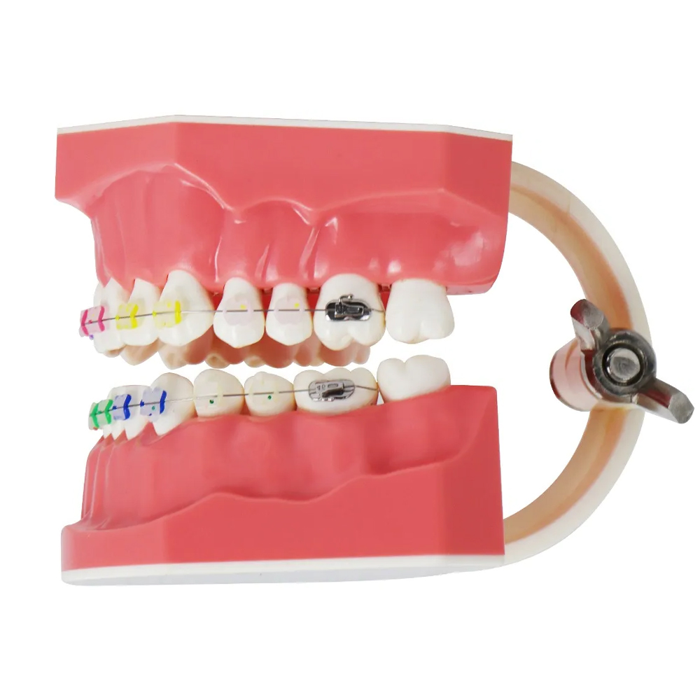 iDENTical Orthodontic Patient Education Model (Ceramic) - M3002